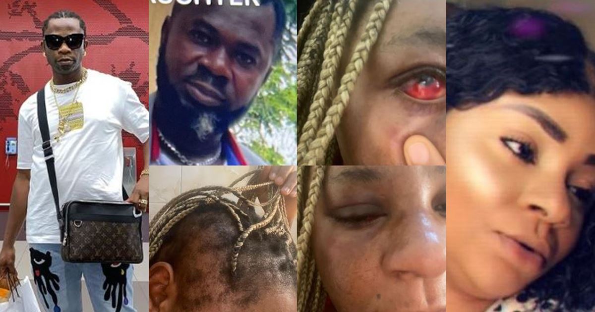 Rapper, Speed Darlington cries out after his sister was physically abused by her husband